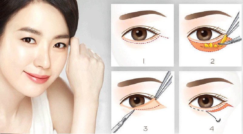 Tham My Vien Tam 164570