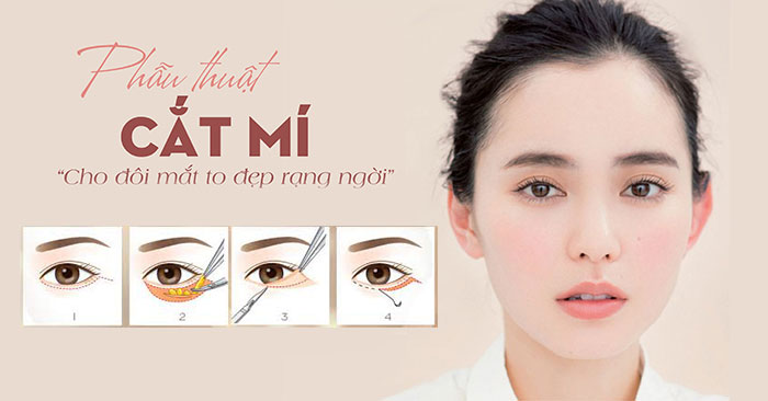 cat mi duoi perfect uy tin hang dau tai tphcm suamimat 1