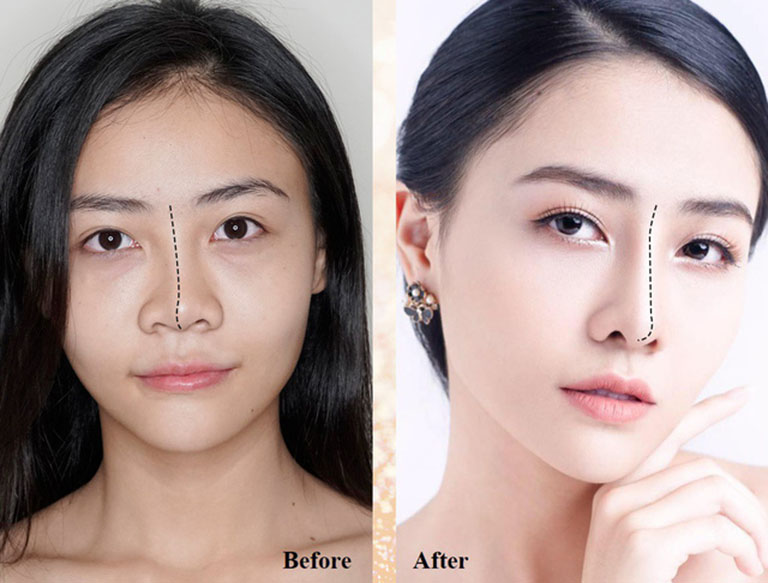 dia chi sua mui hong tai tphcm