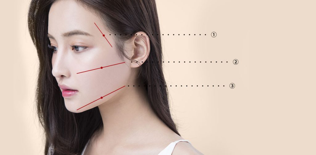 meshlifting principle img1