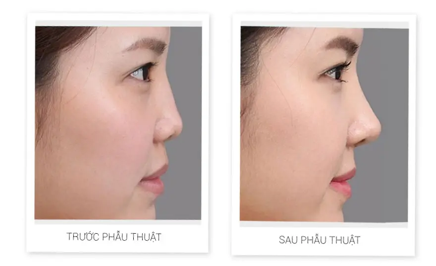 nang mui han quoc 01