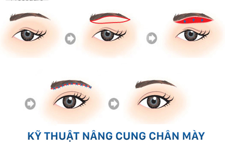 treo chan may giu duoc bao lau 1